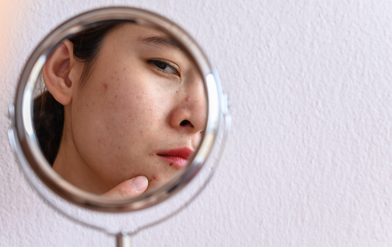 skin barrier 3