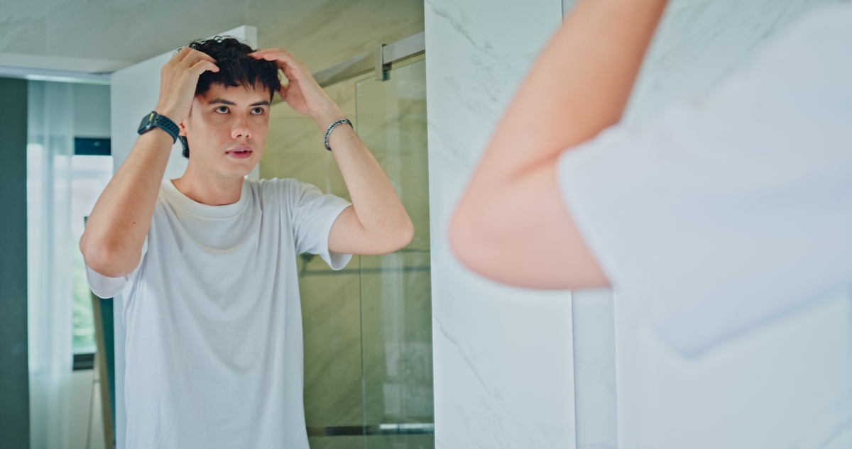 Semua Hal tentang Kebotakan Dini, Masalah yang Sering Terjadi pada Laki-laki!