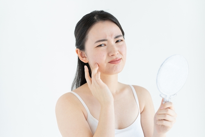 Apa Itu Cortisol Face yang Lagi Viral? Benarkah Stres Bikin Wajah Puffy?