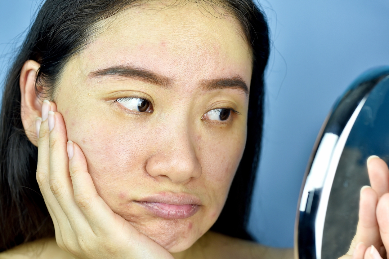 Bukan Cuma Vitamin C, Ini 5 Ingredients untuk Kulit Kusam yang Mungkin Belum Kamu Tahu