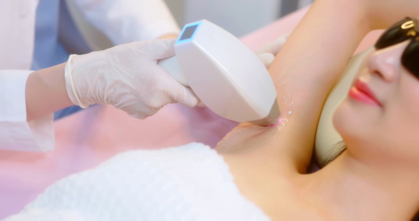 Diode Laser untuk Bulu Ketiak, Lebih Efektif dari IPL?