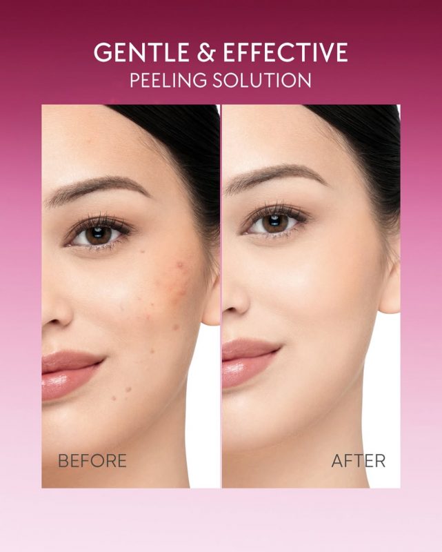 Tips eksfoliasi dengan Skintific Peeling Solution