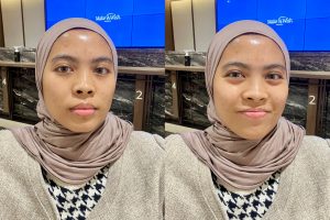 skin booster erha ultimate