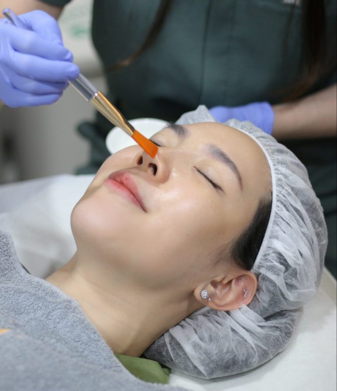 treatment untuk hiperpigmentasi