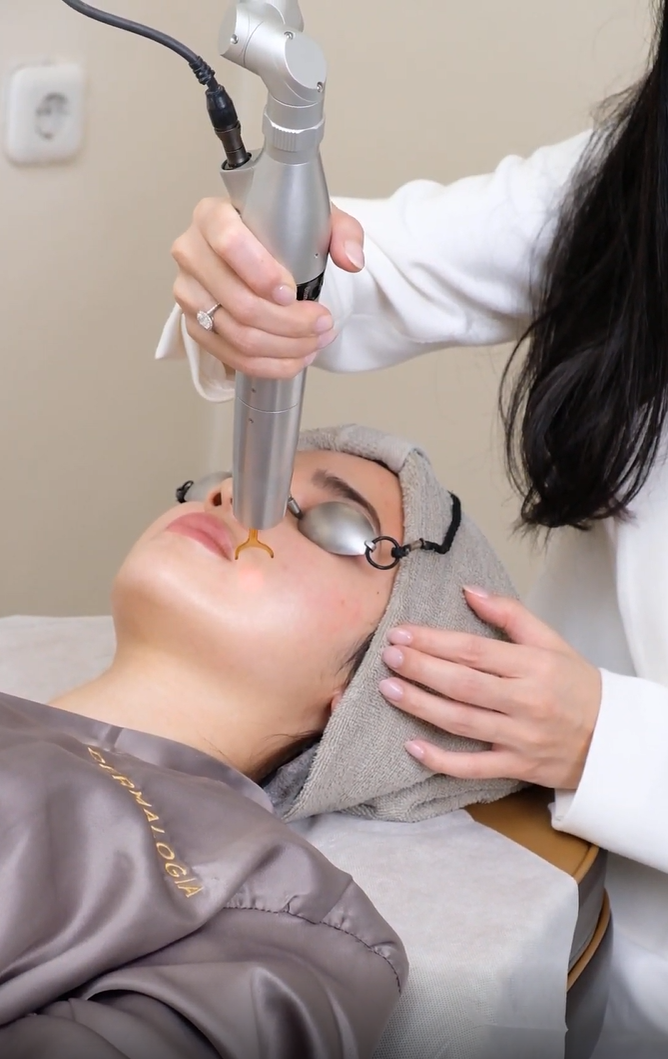 Treatment Nikahan Syifa Hadju