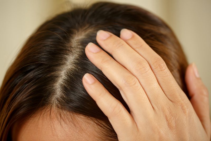 hair growth