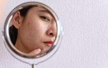 skin barrier 3