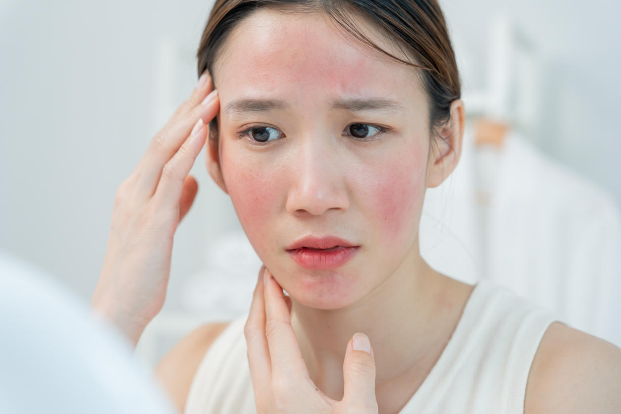 Kulit Perih Saat Pakai Skincare? Bisa Jadi Ini Penyebabnya