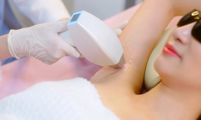 Diode Laser untuk Bulu Ketiak, Lebih Efektif dari IPL?